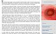 Histeroskopia Newsletter 3.4