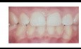 Wstęp do periodontologii | definicja periodontologii | wykłady z periodontologii