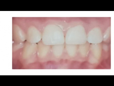 Wstęp do periodontologii | definicja periodontologii | wykłady z periodontologii