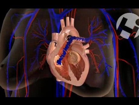 Prawidłowa anatomia i fizjologia serca