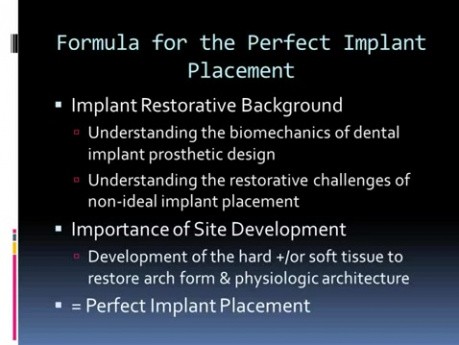 Sposób na idealne umiejscowienie implantu