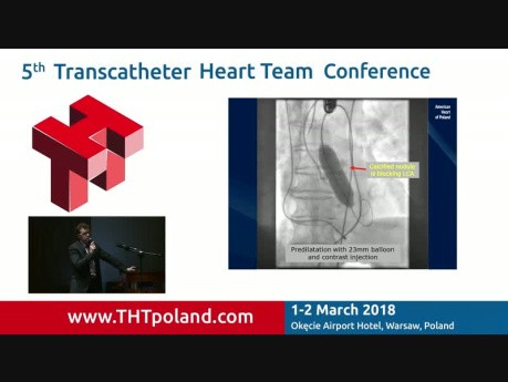 Acute LM Occlusion During TAVI with Selfexpanding Valve in Patient with Biscupid Anatomy