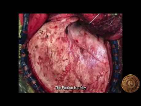Pterion