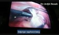 Chirurgia laparoskopowa skrętu torbieli jajnika ze ścisłymi zrostami