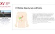 Zakończona sukcesem jednoetapowa rekonstrukcja żołądkowo-jelitowa w zaawansowanej chorobie Leśniowskiego-Crohna u chorego po licznych laparotomiach. Studium przypadku.