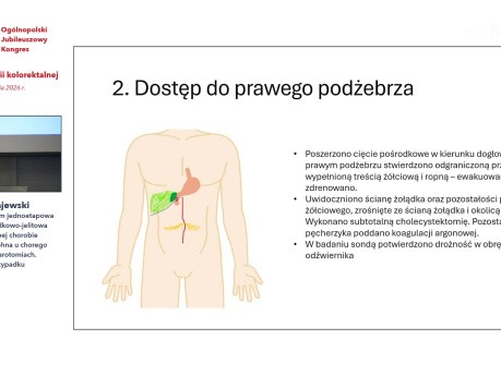 Zakończona sukcesem jednoetapowa rekonstrukcja żołądkowo-jelitowa w zaawansowanej chorobie Leśniowskiego-Crohna u chorego po licznych laparotomiach. Studium przypadku.
