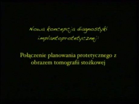 Planowanie i wykonywanie suprastruktury cyrkonowej na implantach z wykorzystaniem tomografii stożkowej - część 1 