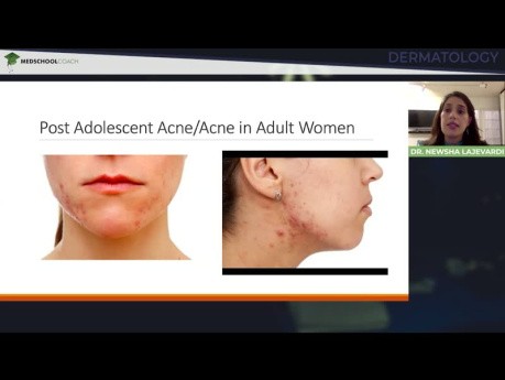 Więcej niż powierzchowność: życie dermatologa