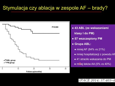 Zespół tachykardia-bradykardia. Ablacja czy stymulator? Prof. dr hab. n. med. Piotr Kułakowski