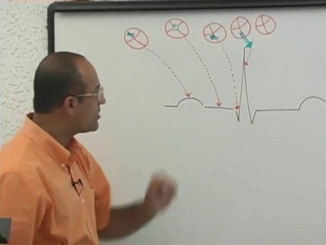 Interpretacja EKG 15/20 - fizjologia serca - USMLE Step 1