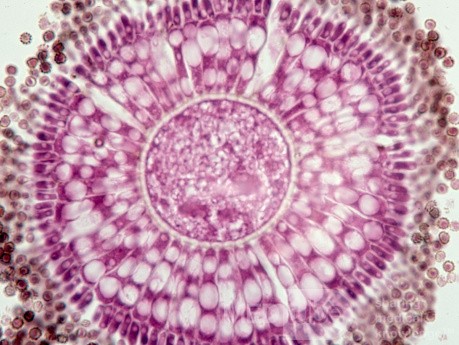 Główkowaty kropidlak czarny [Aspergillus Niger (histologia)]