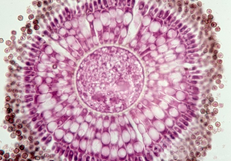 Główkowaty kropidlak czarny [Aspergillus Niger (histologia)]