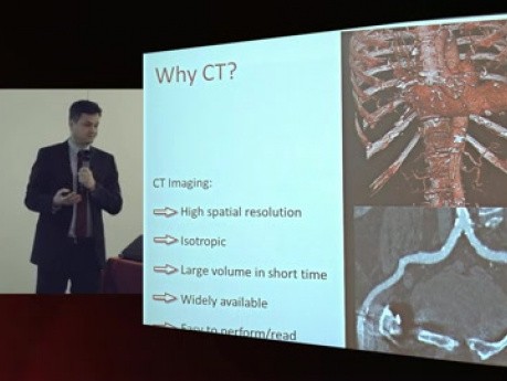 Jak wykonywać MSCT przed procedurą TAVI