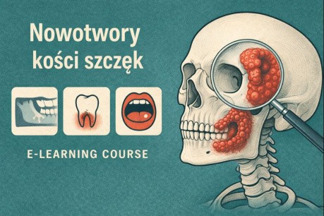 Nowotwory kości szczęk