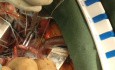 Naprawa zastawki mitralnej w małoinwazyjnej chirurgii serca (MICS) - technika bezpośredniej kaniulacji