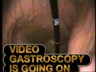 Gastroskopia