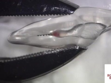 Omijanie złamanego narzędzia i usuwanie go fragmentami