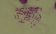 Chromosomy - Kariotyp