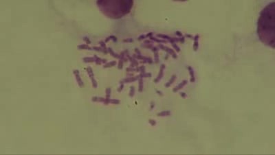 Chromosomy - Kariotyp