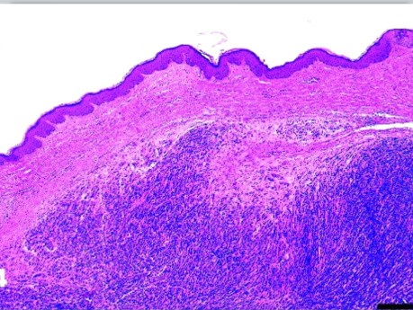 Histopatologia - zakaźny nowotwór diabła tasmańskiego