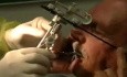 Protezy dentystyczne - wizyta z modelami woskowymi - estetyka, relacja centralna, pionowy wymiar okluzji