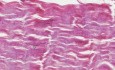 Gęsty regularne tkanki łącznej - histologia