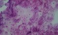 Kanał szyjki macicy - Cytologia - Normalny wzrost komórek