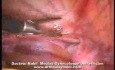 Laparoskopia w aspekcie hipoplazji macicy