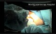 Transanalna mikrochirurgia endoskopowa
