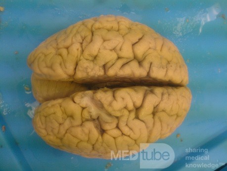 Mózg- narząd  sekcyjny