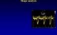 Echokardiograficzny pomiar pojemności minutowej serca
