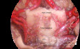 Anatomiczne przeźrocze