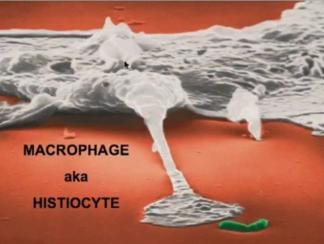 Choroby układu immunologicznego - patomorfologia - część 6b