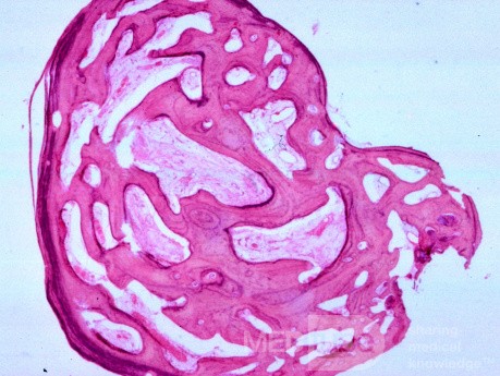 Kostniak przewodu zewnętrznego ucha (histologia)