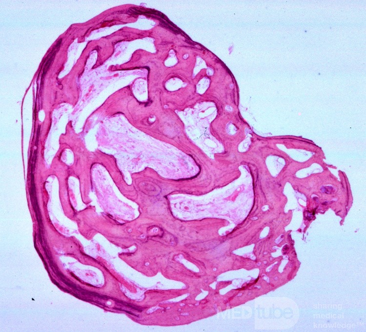 Kostniak przewodu zewnętrznego ucha (histologia)