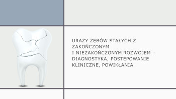 Urazy zębów stałych