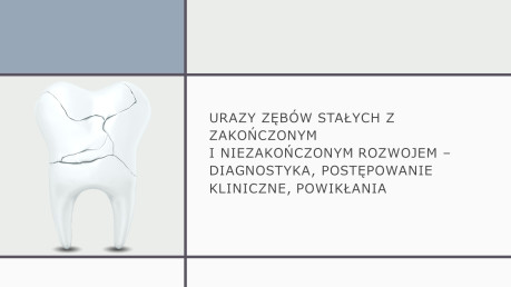 Urazy zębów stałych