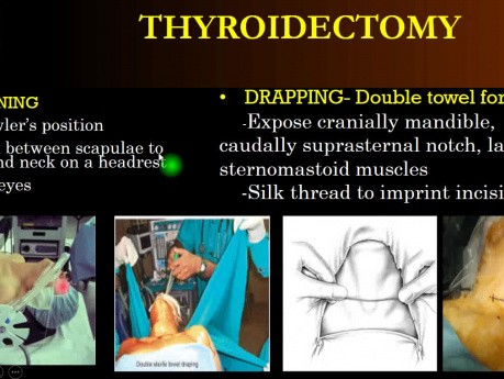 Tyroidektomia 