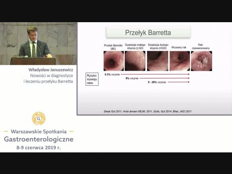 Nowości w diagnostyce i leczeniu przełyku Barretta