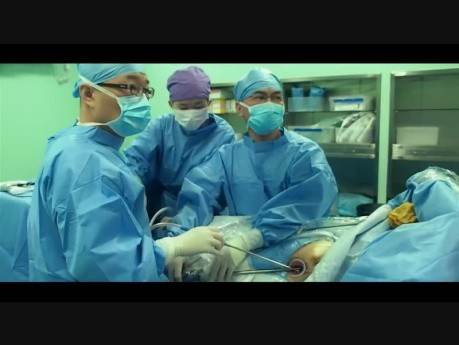 Program treningowy w zabiegach wideotorakoskopowych z jednego cięcia w Shanghai Pulmonary Hospital