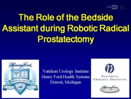 Rola asysty podczas radykalnej prostatektomii w asyście robota 
