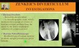 Dysfagia - uchyłek Zenkera