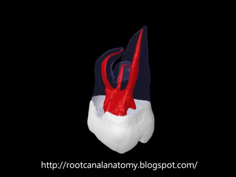 Anatomia kanałów korzeniowych drugiego trzonowca szczęki