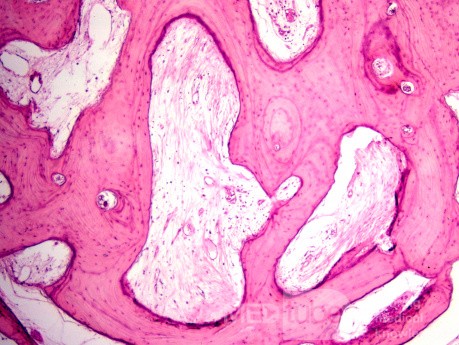 Kostniak ucha zewnętrznego (histologia)