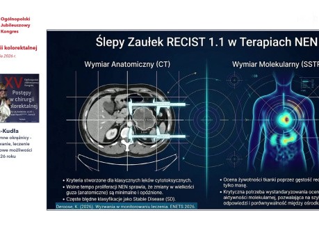 Guzy neuroendokrynne okrężnicy - diagnostyka, rokowanie, leczenie pozachirurgiczne, nowe możliwości terapii w 2026 roku