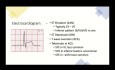 Kardiomiopatia takotsubo (zespół złamanego serca)