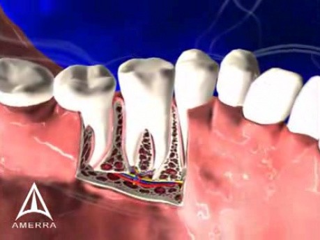 Budowa anatomiczna zębów