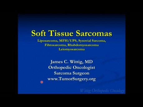 Kurs z ortopedii onkologicznej – mięsaki tkanek miękkich (tłuszczakomięsak, złośliwy włóknisty histiocytoma i inne) – wykład 10