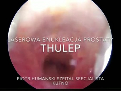 Laserowa enukleacja prostaty laserem Tulowym ThuLEP