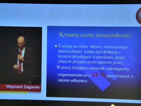 Powikłania po operacyjnym leczeniu raka jelita grubego - prof. Wojciech Zegarski